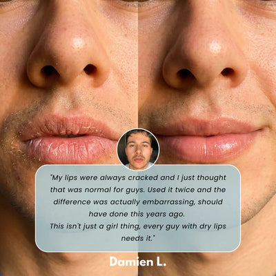 Vyxure - Soothing Prep Lip Mask
