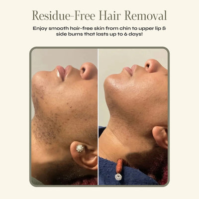 Vyxure - Painless Hair Removal Cream
