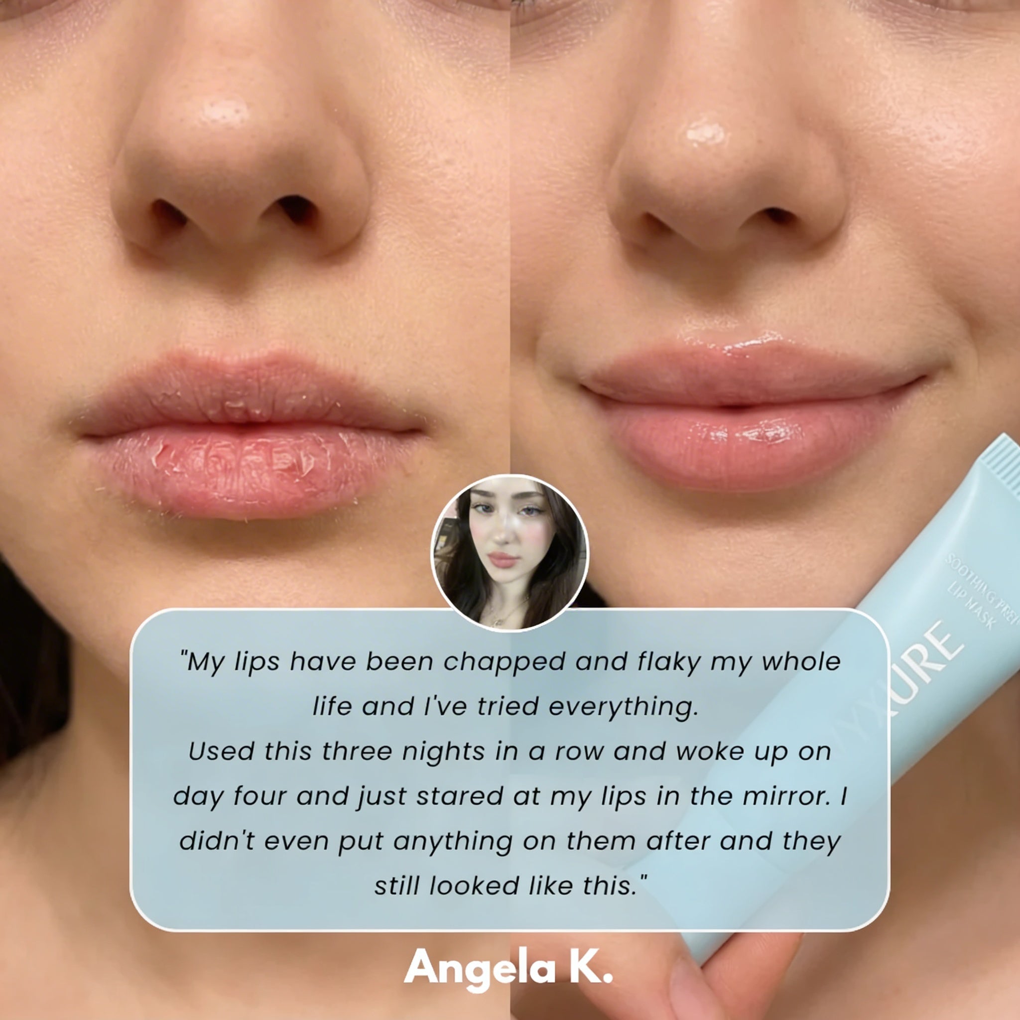 Vyxure - Soothing Prep Lip Mask