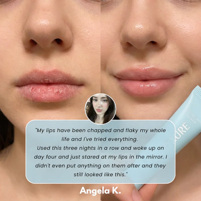 Vyxure - Soothing Prep Lip Mask